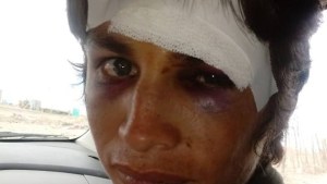 Denuncian brutal golpiza y amenazas a militantes de la CCC en Roca