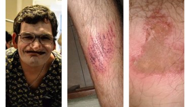 Denunciaron que un chófer y un policía golpearon a un joven con discapacidad