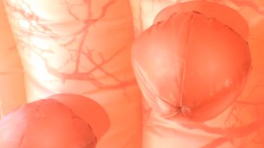 Gastroenterólogas recibirán consultas en la calle sobre la  Enfermedad de Crohn