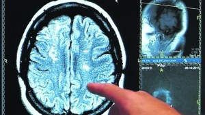 Los misterios del cerebro adolescente