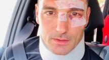 Imagen de España: Scaloni, DT de Argentina, sufrió un accidente en Mallorca