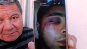 Denunció una salvaje golpiza en una Comisaría de Neuquén