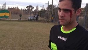 Liga Rionegrina: un árbitro recibió un golpe de puño