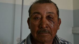 Habló Don Vicente: “La pasé mal con el puma y ahora hay que sanar las heridas”