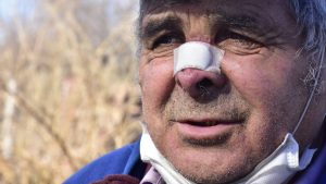 Timoteo Alsina, sin pensión y sin poder trabajar mientras se trata por el tumor en su nariz