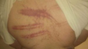 Golpiza a un vecino de Allen: la familia difundió imágenes de la víctima