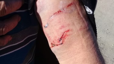 Los perros lo mordieron su brazo izquierdo. Foto: gentileza