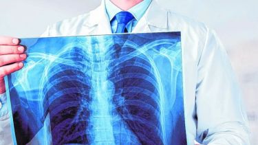 La coordinadora explica que se requiere “un fuerte abordaje epidemiológico para indagar que no haya otra persona enferma”. 