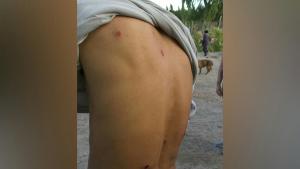 Denuncian agresiones de la Policía y dos heridos en la toma de Confluencia