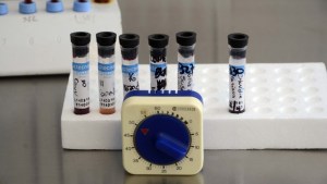 La batalla que se ganó contra el hantavirus, a un año del brote de Epuyén