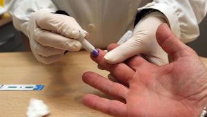 VIH y sífilis: afirman que el 16% de los diagnósticos tardíos dan positivo para ambas enfermedades