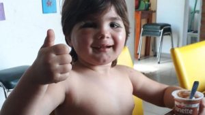 Le dieron de alta al niño que se le derrumbó una pared y le reconstruyeron la cara