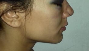 Denunciaron que dos personas sufrieron agresión policial en Plottier