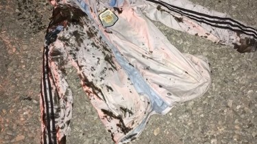 Una campera que portaba uno de los acampantes recibió una mezcla de aceite quemado y combustible. Gentileza