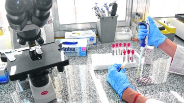 Con un análisis de sangre se puede detectar la sífilis. Se trata y se cura con penicilina. Foto: Juan Thomes