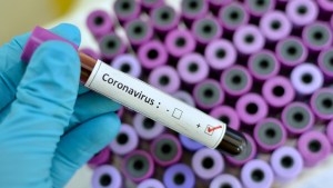 Argentina entre los diez países elegidos por la OMS para probar terapias contra el coronavirus