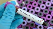 Imagen de Por ahora, se mantiene la cantidad de casos positivos por coronavirus en Río  Negro