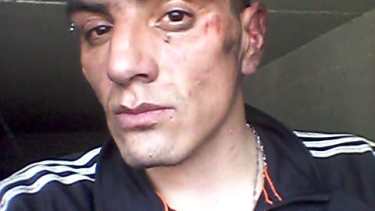 Uno de los internos sufrió heridas. Foto: gentileza