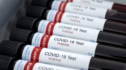 Esta semana, Neuquén sumó 26 nuevos casos confirmados de coronavirus. (Archivo).-