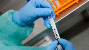 Suman 5.246 los muertos por coronavirus en el país