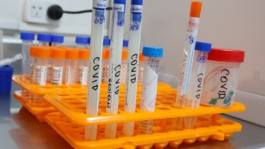 Salud dio a conocer un nuevo reporte de situación por el coronavirus en el país. Foto Juan Thomes. 