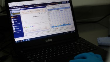 En el recurso se destacó que el software del termociclador mantiene un registro de todas las pruebas realizadas.