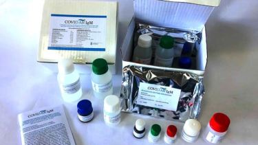 Equipo científico argentino desarrolló un nuevo test serológico. Foto Télam. 