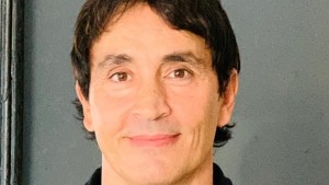 Sebastián Estevanez mostró su rostro tras quemaduras en un accidente doméstico