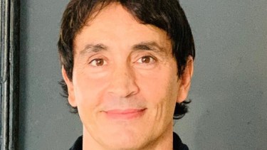 Sebastián Estevanez mostró su rostro tras quemaduras en un accidente doméstico