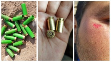 Los casquillos y vainas servidas que fueron recolectadas en la toma. Foto: La Izquierda Diario