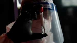 Argentina pasó hoy los 41.000 contagios de coronavirus en un solo día