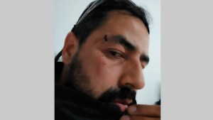 Asaltaron y golpearon a un chofer de colectivo mientras descansaba en Loteo Social