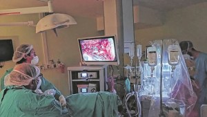 Inédita cirugía en Roca a un paciente con cáncer de pulmón, en plena pandemia