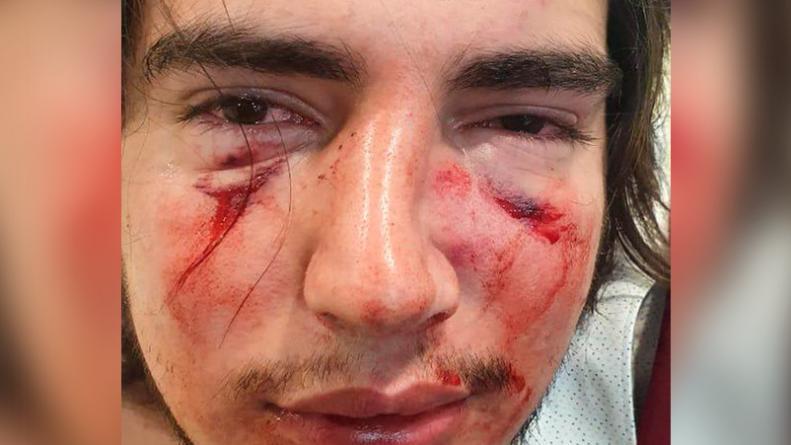 Rugbiers atacaron a un joven en Córdoba. Foto: gentileza 