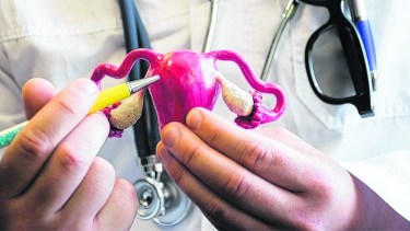 El tejido que normalmente recubre el útero crece fuera de él.