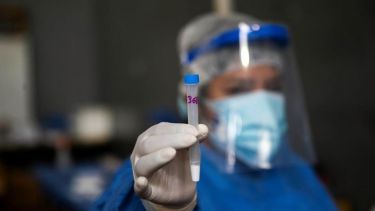 La llegada de la nueva variante preocupa a autoridades y personal de Salud.-