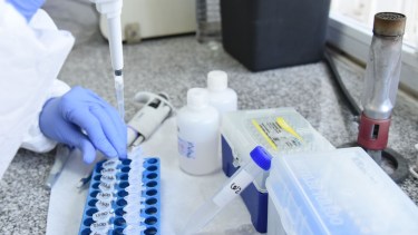 El test rápido de coronavirus. Foto: Florencia Salto