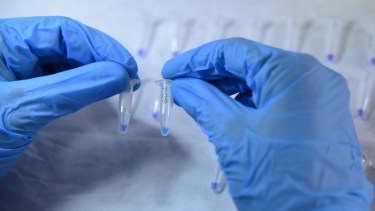 El test rápido de coronavirus. Foto: Florencia Salto