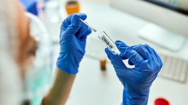 «Pasamos de recibir unas 50 muestras diarias a recibir 700 u 800», indicó Pianciola del Laboratorio Central