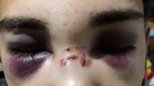 Denuncian que un joven de Centenario fue agredido brutalmente por la policía