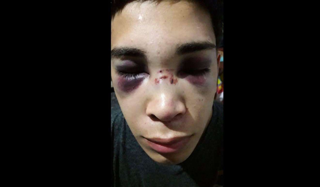 Un joven de Centenario denuncia que la policía lo agredió de forma brutal, (Foto facebook Erica Villalobos)