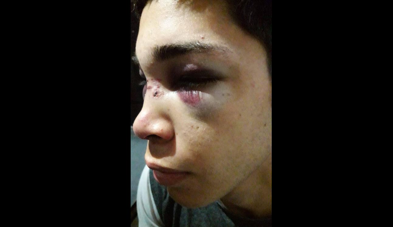 Un joven de Centenario denunció que la policía lo agredió de forma brutal, (Foto facebook Erica Villalobos)