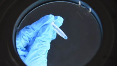 El test rápido de coronavirus. Foto: Florencia Salto