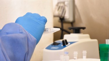 Las muestras de los testeos son analizadas por el Laboratorio Central. Foto: Florencia Salto