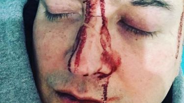 Esta es una de las fotos que el músico Leo García compartió en sus redes, después del ataque. 