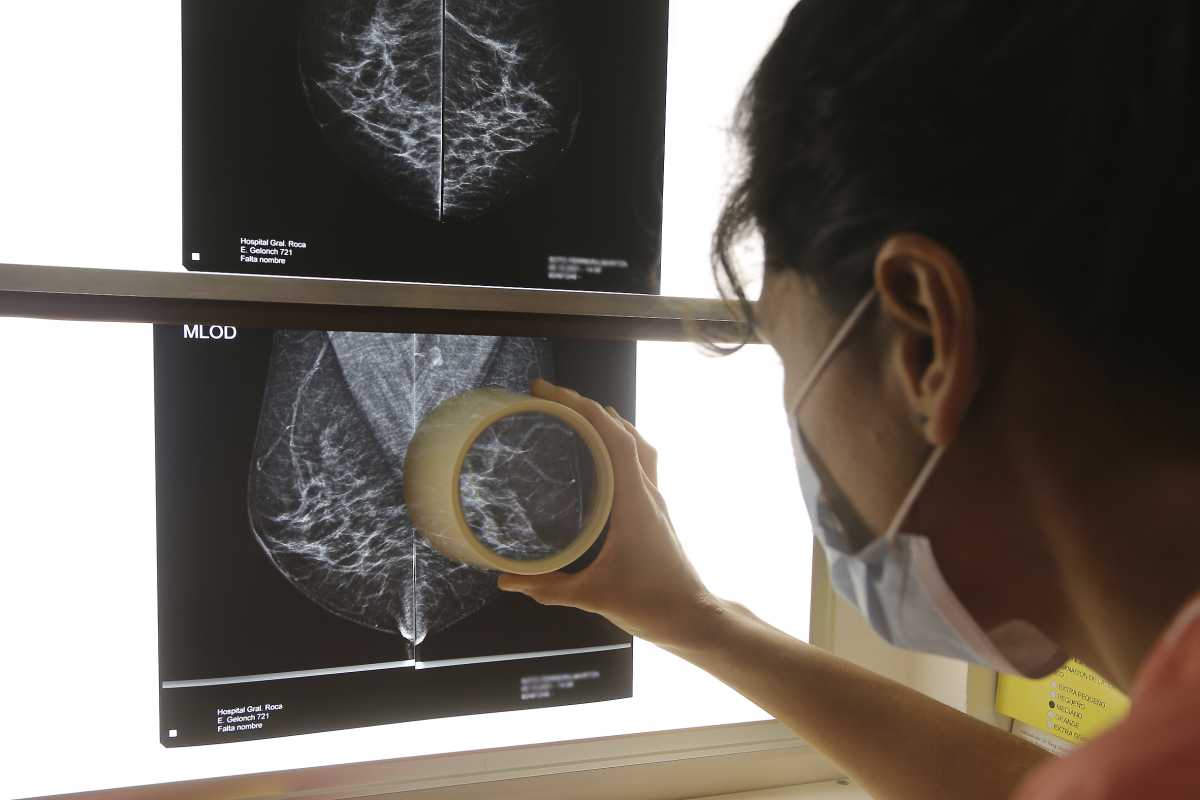 Realizan mamografías gratis en Neuquén por el mes de la sensibilización sobre el cáncer de mama. (Foto Archivo Juan Thomes) 