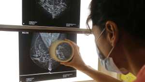 Octubre Rosa: dónde se hacen mamografías gratis en Neuquén 