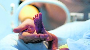 Qué se debe hacer para evitar que los bebés nazcan antes de tiempo