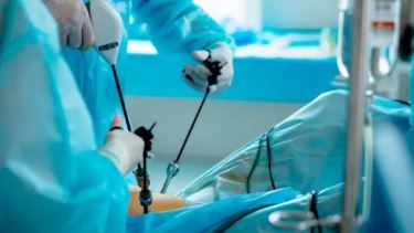 La laparoscopia es una  de las técnicas que se pueden usar para esta cirugía.