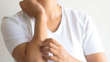 El tratamiento de base de la dermatitis atópica es la humectación constante de la piel con cremas y emolientes para recomponer la barrera cutánea.